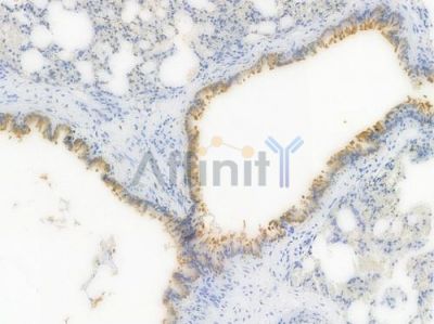 ALDH1A1 Recombinant Rabbit mAb - BF3691 at 1/100 staining Rat lung tissue by IHC-P.