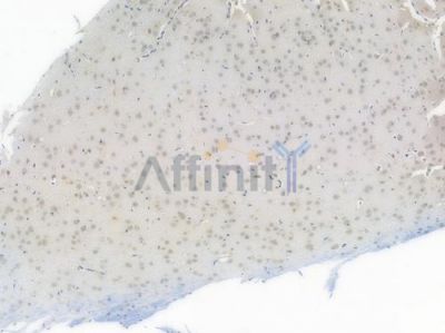 NR1D1 Recombinant Rabbit mAb - BF3706 at 1/100 staining Rat brain tissue by IHC-P.