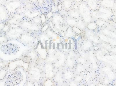 NR1D1 Recombinant Rabbit mAb - BF3706 at 1/100 staining Human renal tissue by IHC-P.