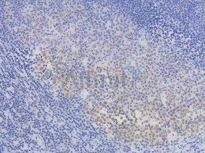 NR1D1 Recombinant Rabbit mAb - BF3706 at 1/100 staining Human tonsil tissue by IHC-P.