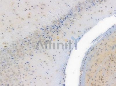 NR1D1 Recombinant Rabbit mAb - BF3706 at 1/100 staining Mouse brain tissue by IHC-P.