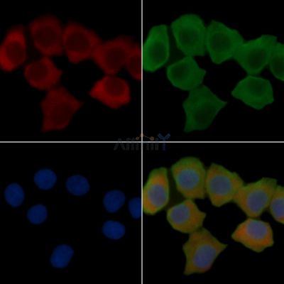 WNT2B Recombinant Rabbit mAb - BF3738 staining Hela cells(30min of UV treatment) by IF/ICC.