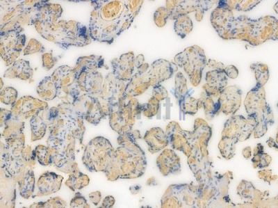 RAB7 Recombinant Rabbit mAb - BF3749 at 1/100 staining Human placental tissue by IHC-P.