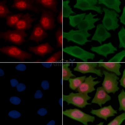 CDC25C Recombinant Rabbit mAb - BF3756 staining Hela cells(30min of UV treatment) by IF/ICC.