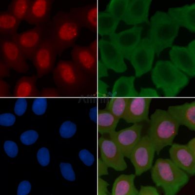 53BP1 Recombinant Rabbit mAb - BF3757 staining Hela cells(30min of UV treatment) by IF/ICC.