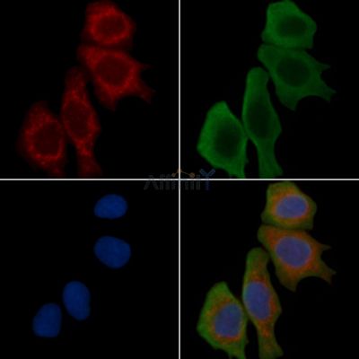 TYROBP Recombinant Rabbit mAb - BF3762 staining Hela cells(30min of UV treatment) by IF/ICC.