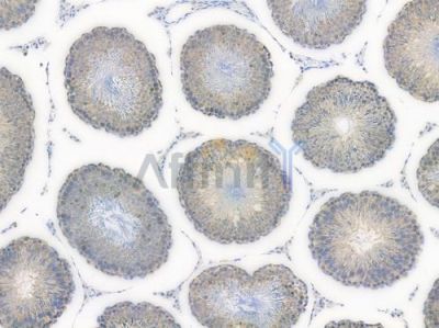 IGF2BP1 Recombinant Rabbit mAb - BF3775 at 1/100 staining Rat testicular tissue by IHC-P.