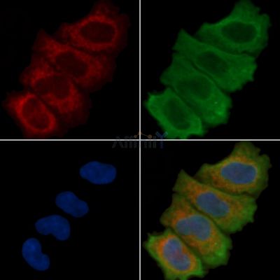 Cytochrome c Oxidase 2 Recombinant Rabbit mAb - BF3778 staining Hela cells(30min of UV treatment) by IF/ICC.