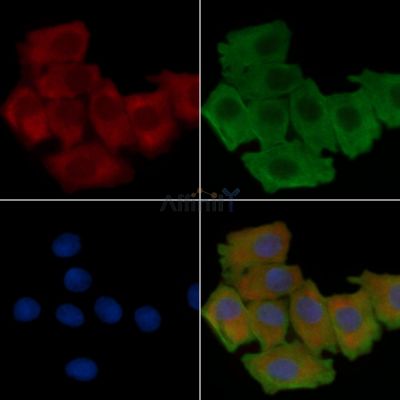 LAMB1 Recombinant Rabbit mAb - BF3780 staining Hela cells(30min of UV treatment) by IF/ICC.