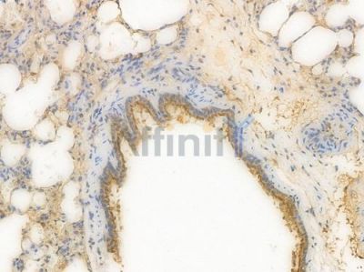 Annexin A1 Recombinant Rabbit mAb - BF3802 at 1/100 staining Rat lung tissue by IHC-P.
