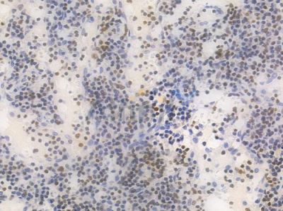 RUNX1 / AML1 Recombinant Rabbit mAb - BF3816 at 1/100 staining Human lymph node tissue by IHC-P.
