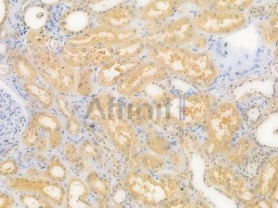 ATF5 Recombinant Rabbit mAb - BF3819 at 1/100 staining Human renal tissue by IHC-P.