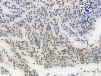 ATF5 Recombinant Rabbit mAb - BF3819 at 1/100 staining Human tonsil tissue by IHC-P.