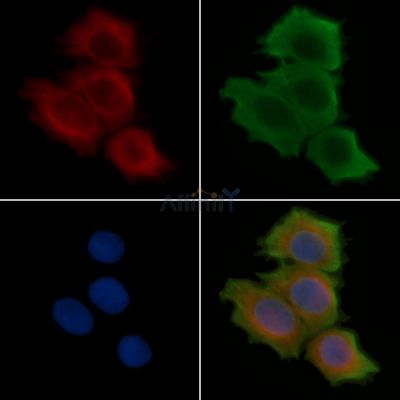 C1QC Recombinant Rabbit mAb - BF3822 staining Hela cells(30min of UV treatment) by IF/ICC.