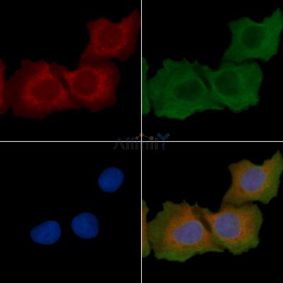 THBD Recombinant Rabbit mAb - BF3823 staining Hela cells(30min of UV treatment) by IF/ICC.