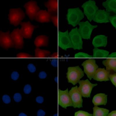 BATF Recombinant Rabbit mAb - BF3830 staining Hela cells(30min of UV treatment) by IF/ICC.