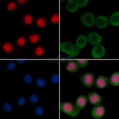 HDAC9 Recombinant Rabbit mAb - BF3833 staining Hela cells(30min of UV treatment) by IF/ICC.