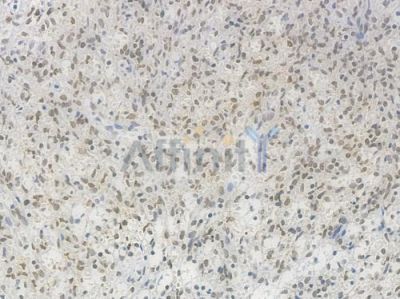 HDAC9 Recombinant Rabbit mAb - BF3833 at 1/100 staining Human spleen tissue by IHC-P.