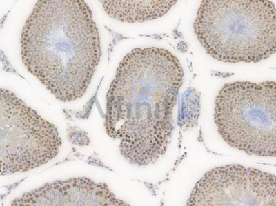 HDAC9 Recombinant Rabbit mAb - BF3833 at 1/100 staining Rat lung tissue by IHC-P.