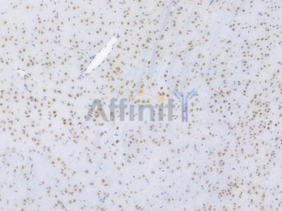 HDAC9 Recombinant Rabbit mAb - BF3833 at 1/100 staining Mouse brain tissue by IHC-P.