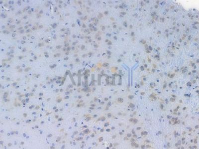 BTF3 Recombinant Rabbit mAb - BF3880 at 1/100 staining Mouse brain tissue by IHC-P.