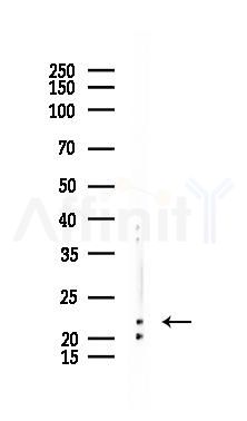 BTF3 Recombinant Rabbit mAb - Western blot analysis of lysates from Mouse testis, using BTF3 Recombinant Rabbit mAb at 1/1000 dilution.