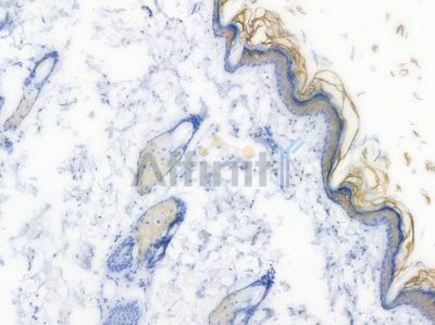 FGG Recombinant Rabbit mAb - BF3881 at 1/100 staining Rat skin tissue by IHC-P.
