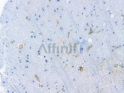 Annexin A2 Recombinant Rabbit mAb - BF3885 at 1/100 staining Human brain tissue by IHC-P.