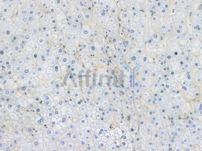 Annexin A2 Recombinant Rabbit mAb - BF3885 at 1/100 staining Human liver tissue by IHC-P.