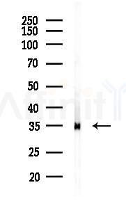 Annexin A2 Recombinant Rabbit mAb - Western blot analysis of lysates from K562 cells(heat-shock 45min treatment), using Annexin A2 Recombinant Rabbit mAb at 1/1000 dilution.