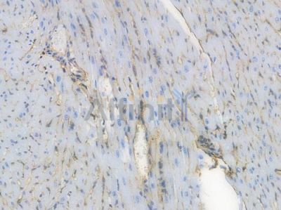 Annexin A2 Recombinant Rabbit mAb - BF3888 at 1/100 staining Mouse heart tissue by IHC-P.