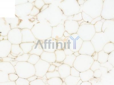 Annexin A2 Recombinant Rabbit mAb - BF3888 at 1/100 staining Human breast tissue by IHC-P.