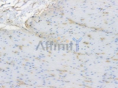 Annexin A2 Recombinant Rabbit mAb - BF3888 at 1/100 staining Human intestinal tissue by IHC-P.