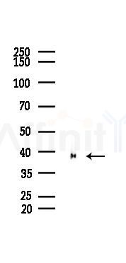 Annexin A2 Recombinant Rabbit mAb - Western blot analysis of lysates from Rat spleen, using Annexin A2 Recombinant Rabbit mAb at 1/1000 dilution.