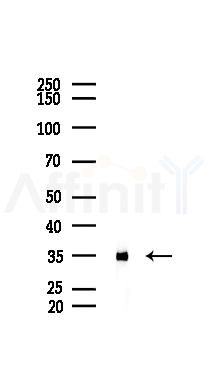 Annexin A2 Recombinant Rabbit mAb - Western blot analysis of lysates from PC12 cells(LPS 4h treatment), using Annexin A2 Recombinant Rabbit mAb at 1/1000 dilution.