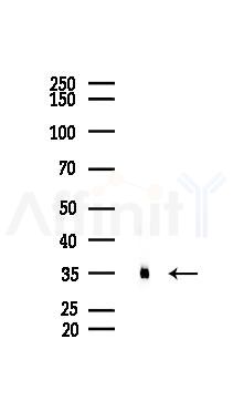 Annexin A2 Recombinant Rabbit mAb - Western blot analysis of lysates from B16F10-LUC cells(heat-shock 45min treatment), using Annexin A2 Recombinant Rabbit mAb at 1/1000 dilution.