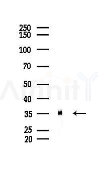 Annexin A2 Recombinant Rabbit mAb - Western blot analysis of lysates from RAW264.