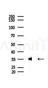Annexin A2 Recombinant Rabbit mAb - Western blot analysis of lysates from HUVEC cells(UV 30min treatment), using Annexin A2 Recombinant Rabbit mAb at 1/1000 dilution.