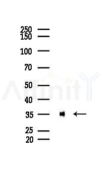 Annexin A2 Recombinant Rabbit mAb - Western blot analysis of lysates from HepG2 cells(UV 30min treatment), using Annexin A2 Recombinant Rabbit mAb at 1/1000 dilution.