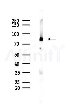 MCM5 Recombinant Rabbit mAb - Western blot analysis of lysates from HUVEC cells(UV 30min treatment), using MCM5 Recombinant Rabbit mAb at 1/1000 dilution.