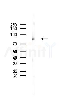 MCM5 Recombinant Rabbit mAb - Western blot analysis of lysates from COLO205 cells(UV 30min treatment), using MCM5 Recombinant Rabbit mAb at 1/1000 dilution.