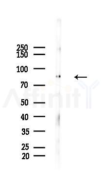 MCM5 Recombinant Rabbit mAb - Western blot analysis of lysates from HepG2 cells(UV 30min treatment), using MCM5 Recombinant Rabbit mAb at 1/1000 dilution.
