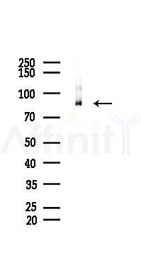 Phospho-PKC alpha (Thr638) Recombinant Rabbit mAb - Western blot analysis of lysates from K562 cells(heat-shock 45min treatment), using Phospho-PKC alpha (Thr638) Recombinant Rabbit mAb at 1/1000 dilution.