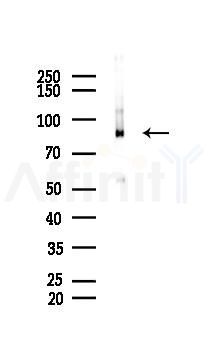 Phospho-PKC alpha (Thr638) Recombinant Rabbit mAb - Western blot analysis of lysates from Hela cells(heat-shock 45min treatment), using Phospho-PKC alpha (Thr638) Recombinant Rabbit mAb at 1/1000 dilution.