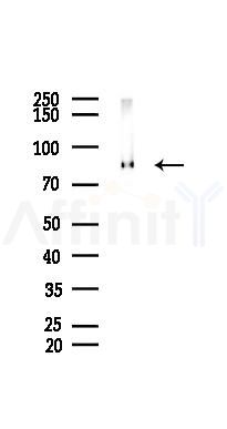 Phospho-PKC alpha (Thr638) Recombinant Rabbit mAb - Western blot analysis of lysates from PC12 cells(LPS 4h treatment), using Phospho-PKC alpha (Thr638) Recombinant Rabbit mAb at 1/1000 dilution.
