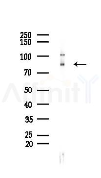 Phospho-PKC alpha (Thr638) Recombinant Rabbit mAb - Western blot analysis of lysates from 293 cells(LPS 4h treatment), using Phospho-PKC alpha (Thr638) Recombinant Rabbit mAb at 1/1000 dilution.