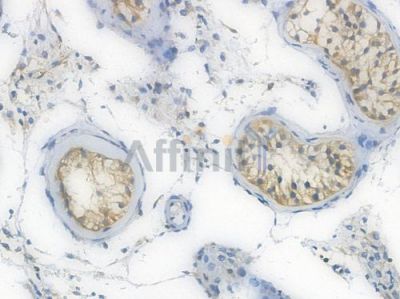 LAT Recombinant Rabbit mAb - BF3892 at 1/100 staining Human testicular tissue by IHC-P.