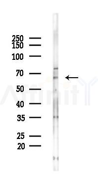 CDC6 Recombinant Rabbit mAb - Western blot analysis of lysates from HUVEC cells(UV 30min treatment), using CDC6 Recombinant Rabbit mAb at 1/1000 dilution.
