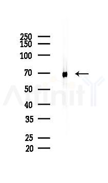 NDUFS1 Recombinant Rabbit mAb - Western blot analysis of lysates from Mouse testis, using NDUFS1 Recombinant Rabbit mAb at 1/1000 dilution.