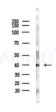 IKB alpha Recombinant Rabbit mAb - Western blot analysis of lysates from Mouse liver, using IKB alpha Recombinant Rabbit mAb at 1/1000 dilution.